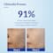 Fixderma Skarfix -TX Cleanser Kojic Acid Niacinamide  For Dark Spots Exfoliators Face Wash (75g)