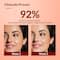Fixderma 2% Kojic Acid + 1% Arbutin Skarfix-Plus Scar Removal Cream (30g)