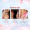 Aqualogica Refresh+ Perfume Body Mist - Cherry Blossom Bloom (150 ml)
