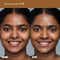 FAE BEAUTY Face Card 4-in-1 Super Serum Skin Tint With Dewy Finish, Shade -71O - Warm Olive (30 ml)