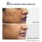 Novology Pigmentation Reduction Moisturiser for Dark Spots Acne Marks and Uneven Skin Tone (50 g)