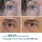 Dr.Melaxin Eyephalt Eyebag Cream (10 g)