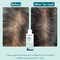 WishCare Hydrating AHA BHA Anti Dandruff Shampoo Reduces Itchiness 100% Dandruff Reduction (120 ml)