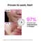 Foxtale 12% Niacinamide Serum with Azelaic Acid for Oil Control & Brightening (30 ml)