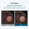 Dr.Melaxin Tx-Cream Targets Dark Spots Hyperpigmentation Post-Acne Scars and Melasma (50 g)