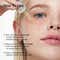 Anua Azelaic Acid 10 Hyaluron Redness Soothing Serum (30 ml)