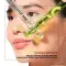 Lakme Blush & Glow Avocado Matcha + Salicylic Acid Jelly Face Wash (100 g)