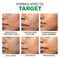 Novology Acne Light Moisturizing Gel for Oily Acne Prone Skin Upto 100 hours of Hydration (50 g)