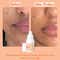 WishCare Super Bright C16 Vitamin C Face Serum for Glowing Skin Reduces Pigmentation (30 ml)