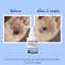 WishCare Hair Growth Serum Concentrate with Redensyl In Vivo Tested Boosts Hair Growth (30 ml)