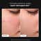 Conscious Chemist 97 % Active Snail Mucin Face Serum For Barrier Repair & Anti Ageing (50ml)