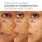 Lakme Perfect Radiance with 5% Niacinamide Night Gel Cream for Pigmentation (50 g)