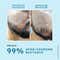 Hyphen Clarifying Acne Cleanser With 2% Salicylic Acid (100 ml)