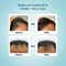Pilgrim 3% Redensyl & 4% Anagain Advanced Hair Growth Serum (30 ml)