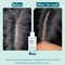 WishCare Hydrating AHA BHA Anti Dandruff Shampoo Reduces Itchiness 100% Dandruff Reduction (120 ml)