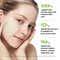 Anua Azelaic 10 Hyaluron Redness Soothing Pad (230 ml)