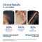 Wishcare Hair Growth Serum Concentrate Roll On - In-Vivo Tested (30 ml)