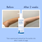WishCare AHA + BHA Exfoliating Body Lotion Provides Deep Hydration and Detan Skin (200 ml)