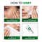 Novology Acne Clearing Cleanser for Acne Whiteheads and Blackheads for Sensitive Skin (100 g)