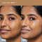FAE BEAUTY Face Card 4-in-1 Super Serum Skin Tint With Dewy Finish, Shade -30N-Warm Neutral (30 ml)
