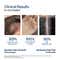 WishCare Hair Growth Serum Concentrate with Redensyl In Vivo Tested Boosts Hair Growth (100 ml)