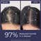 Conscious Chemist Rosemary Water Spray for Hair Growth (200 ml)