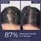 Conscious Chemist Hair Growth & Anti Hair Fall Serum (30 ml)