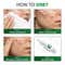 Novology Acne Clearing Serum for Pimples Whiteheads Blackheads For Sensitive Skin (28 ml)