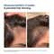 WishCare Hair Growth Serum Concentrate with Redensyl In Vivo Tested Boosts Hair Growth (30 ml)