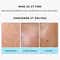 Hyphen 2% Cica Exosome Oil-Free Moisturizer (50 ml)