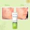 WishCare Anti Acne Kit with 2% Salicylic Acid Face Wash & Niacinamide Face Serum Combo (100ml+30 ml)