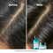 L'OREAL PROFESSIONNEL Scalp Advanced Anti-Oiliness Dermo-Purifier Shampoo (300 ml) for Oily Scalps