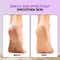 VEGA 4-in-1 Pedicure Foot Scrubber for Dead Skin Callus & Cracked Heels Removal (PD-02N)